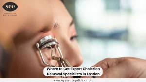 Where to Get Expert Chalazion Removal Specialists in LondonWhere to Get Expert Chalazion Removal Specialists in London