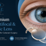 cataract treatment