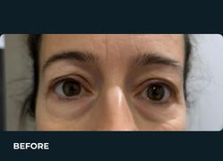 Before – Case 2