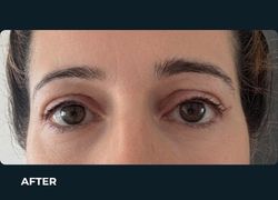 After – Case 2