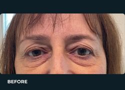Before – Case 4