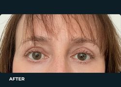After – Case 4