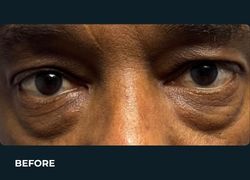 Before – Case 5