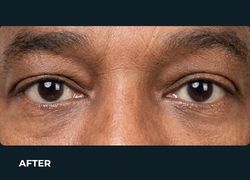 After – Case 6