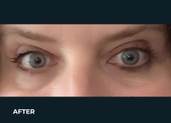 After – Case 10
