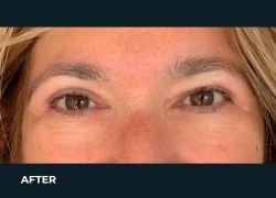 After – Case 8
