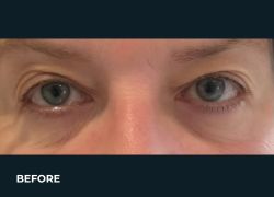 Before – Case 9
