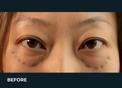 Before – Case 15