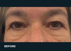Before – Case 7