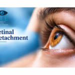 detached retina