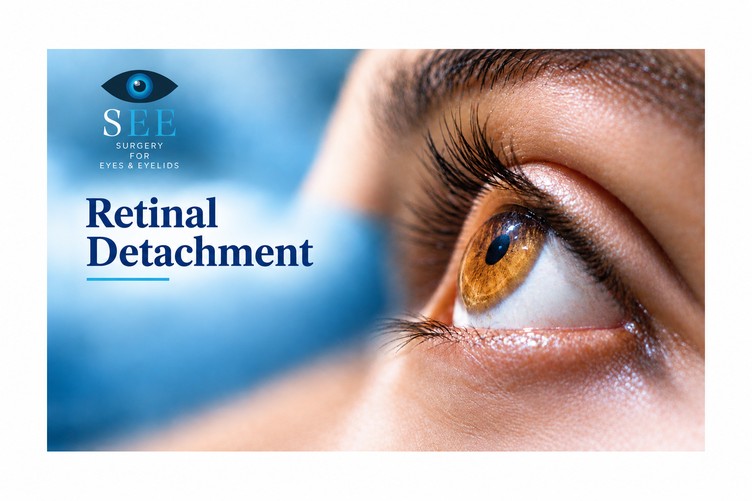 detached retina