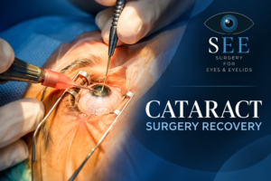 7 Common Myths About Cataract Surgery