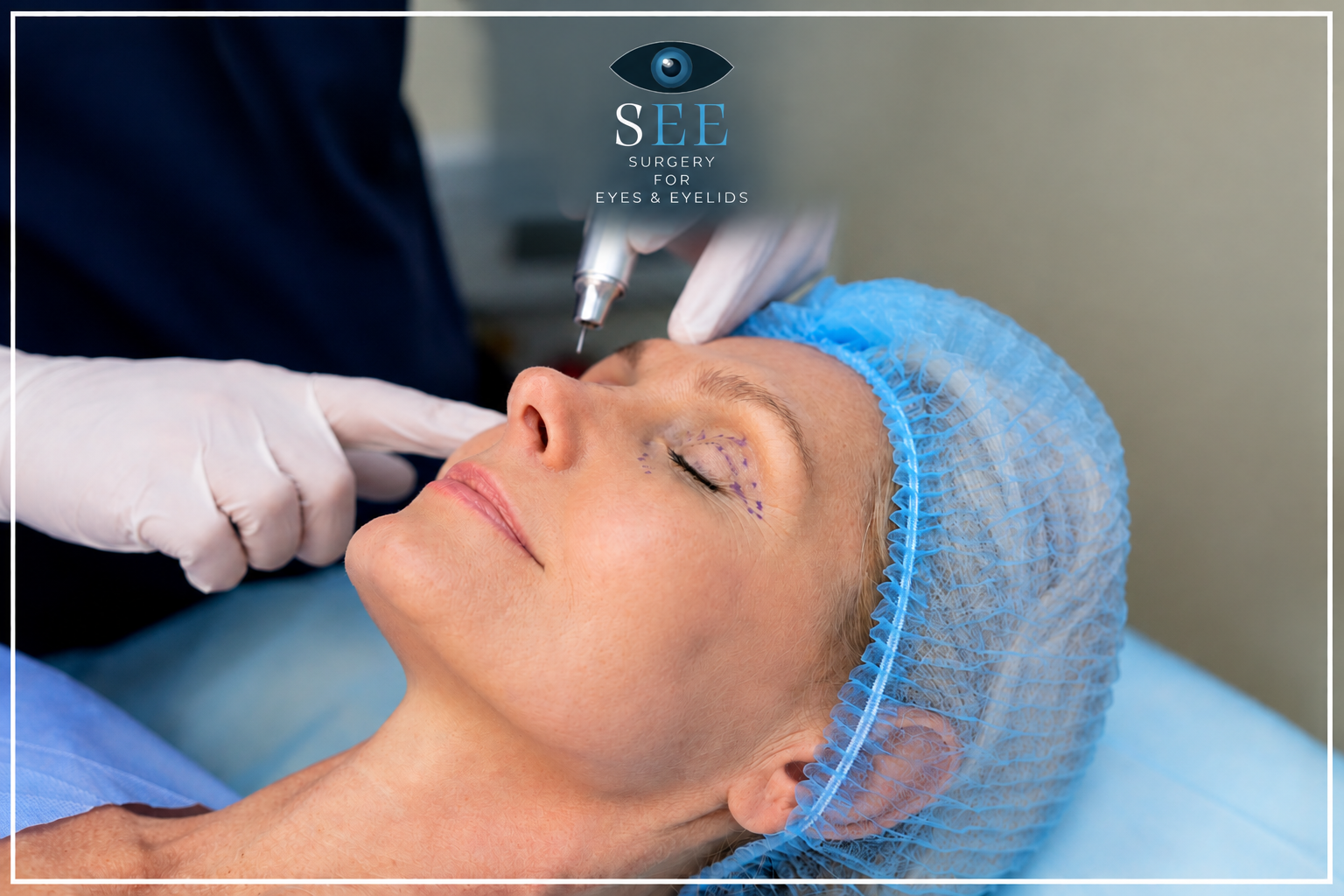 Non-Surgical Eye